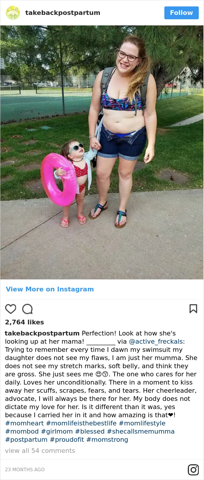 90 Brutally Honest Photos Of Post-Baby Bodies, That Women Are Sharing To Reveal The Truth No One Talks About