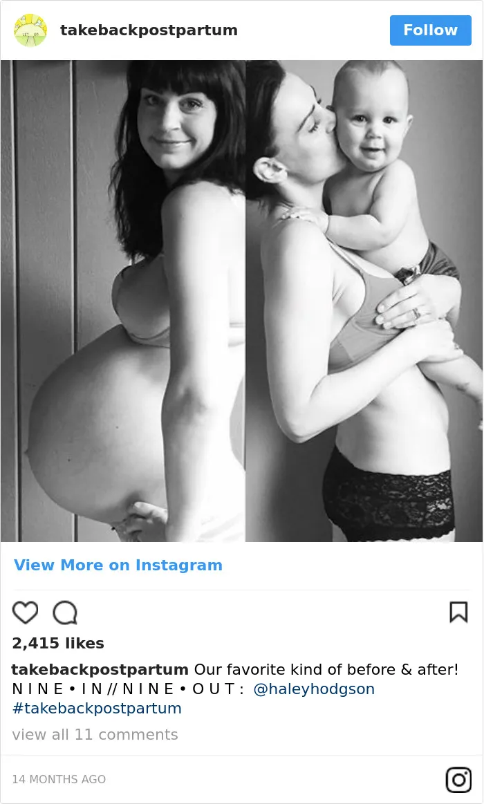90 Brutally Honest Photos Of Post-Baby Bodies, That Women Are Sharing To Reveal The Truth No One Talks About