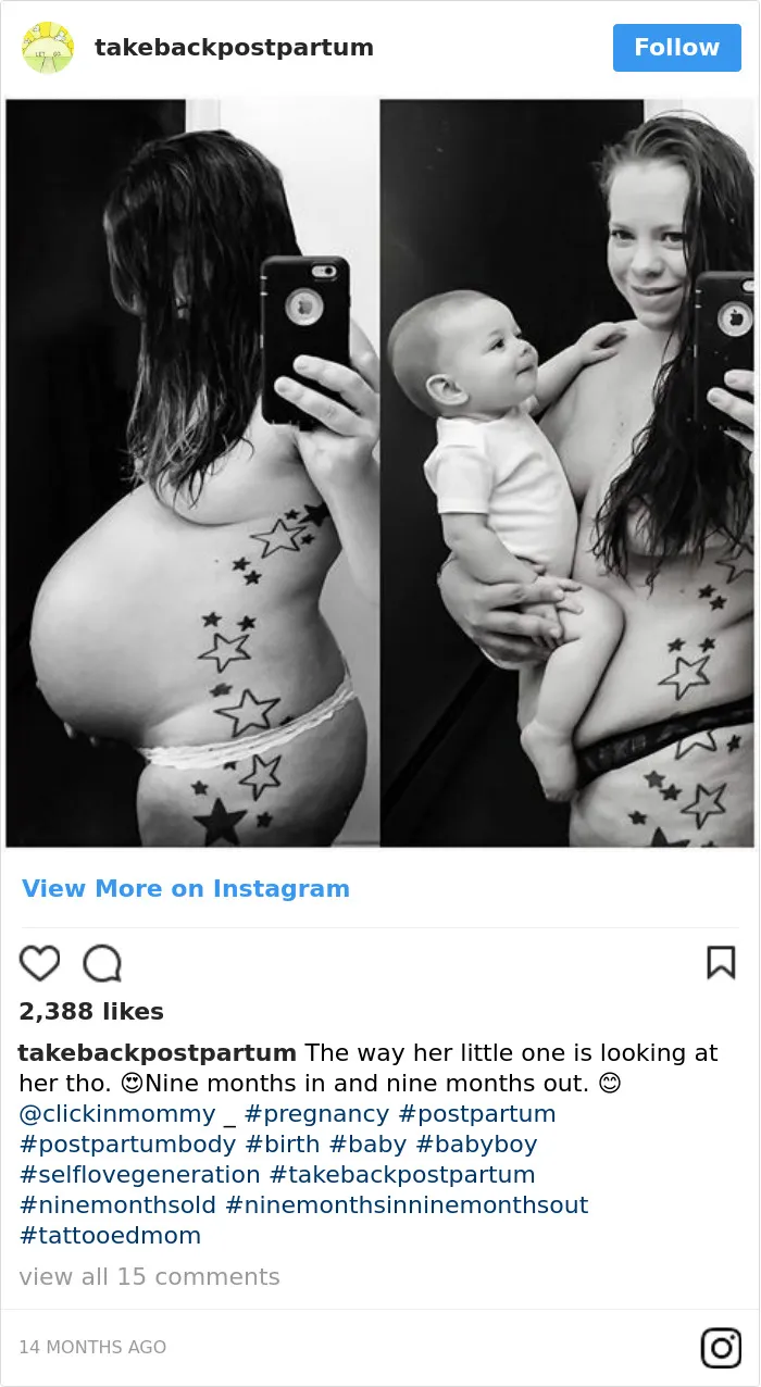 90 Brutally Honest Photos Of Post-Baby Bodies, That Women Are Sharing To Reveal The Truth No One Talks About