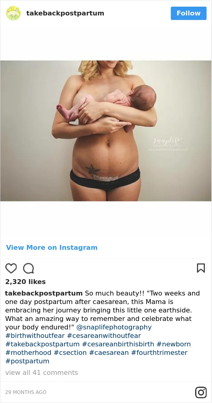 90 Brutally Honest Photos Of Post-Baby Bodies, That Women Are Sharing To Reveal The Truth No One Talks About