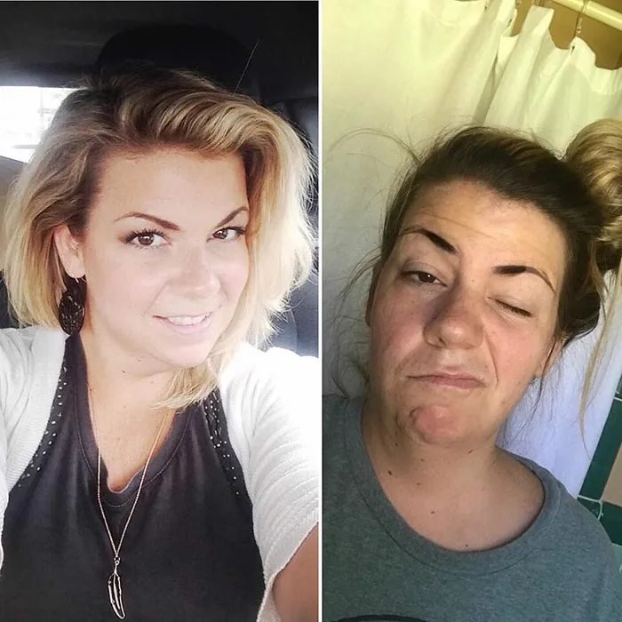 Got Toddlered: Parents Share Photos Of Them Before And After Having Kids, And The Difference Is Hilarious
