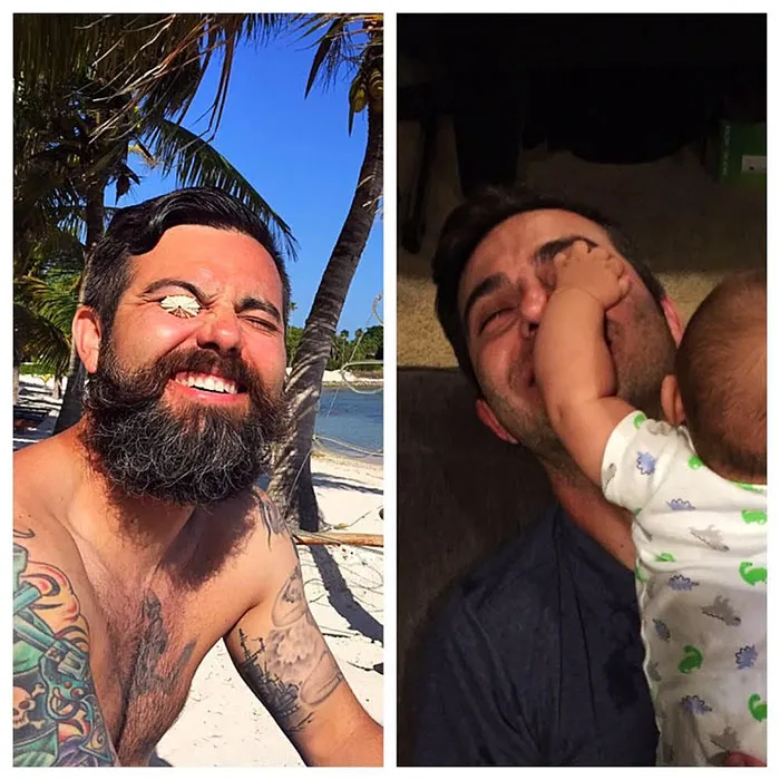Got Toddlered: Parents Share Photos Of Them Before And After Having Kids, And The Difference Is Hilarious