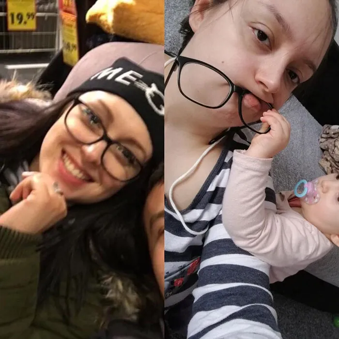 Got Toddlered: Parents Share Photos Of Them Before And After Having Kids, And The Difference Is Hilarious