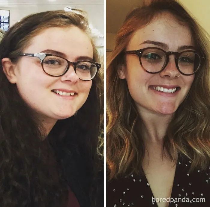 40 Lbs Lost In A Year. Not Done Yet But Face Gains Really Surprised Me!