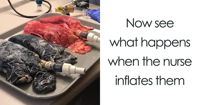 Shocking Video Of Nurse Inflating Healthy Lungs Vs Smoker's Reveals What Cigarettes Really Do To You