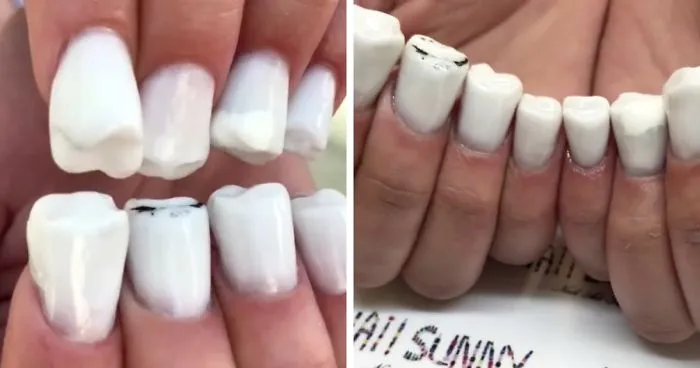 Teeth-Nails Exist, And If You Think They Can't Get Any Worse, Watch This Video