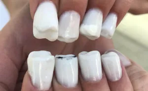 Teeth-Nails Exist, And If You Think They Can't Get Any Worse, Watch This Video