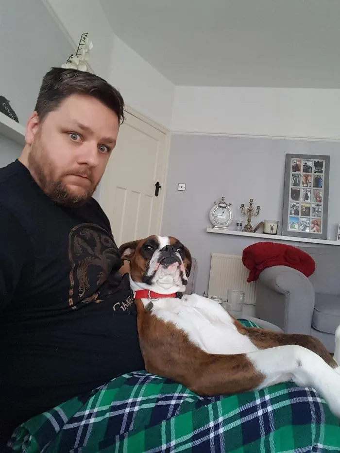 Man with a surprised expression sits on a couch with an adorable boxer dog lying comfortably on his lap.
