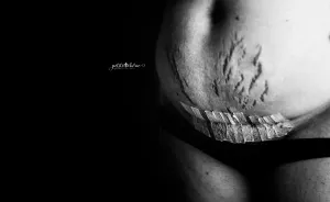 Celebrating The Postpartum Body
