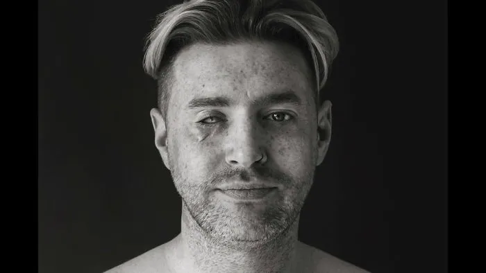 Scar Portraits
