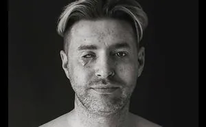 Scar Portraits