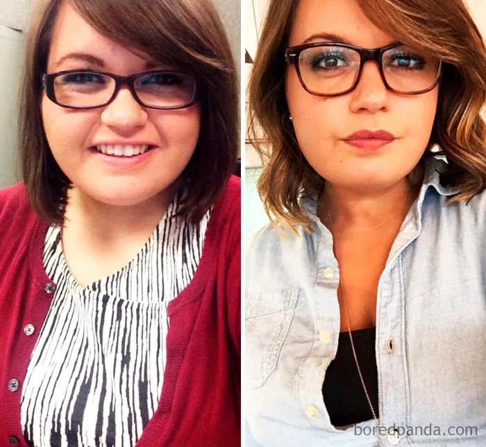Lost 145 Lbs. I Didn’t Realize Even My Nose Lost Weight