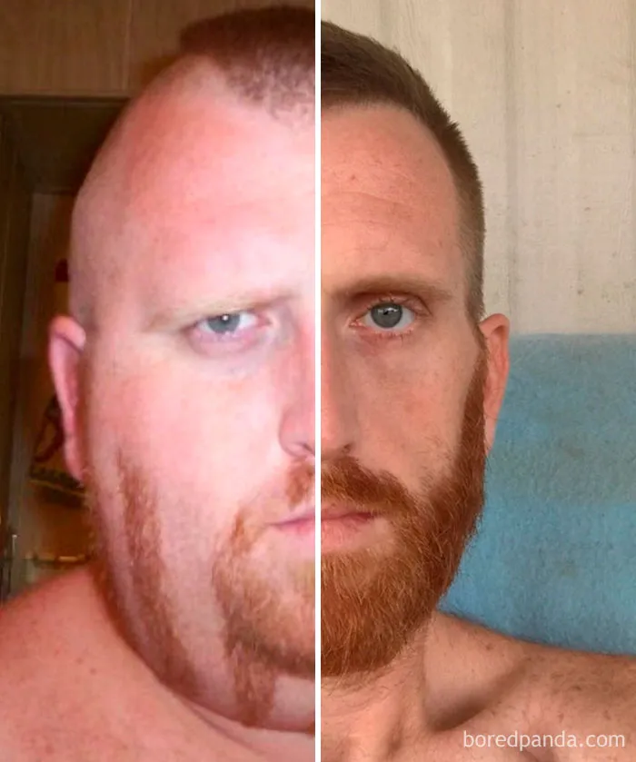 My Face Before & After Losing 350 Pounds
