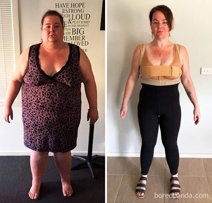 Lost 222 Lbs. Weight Loss Progress