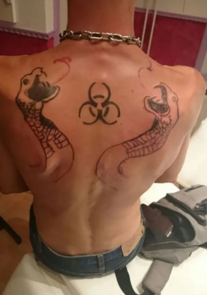 Back tattoo fail with two snakes and a biohazard symbol, highlighting bad tattoo design.