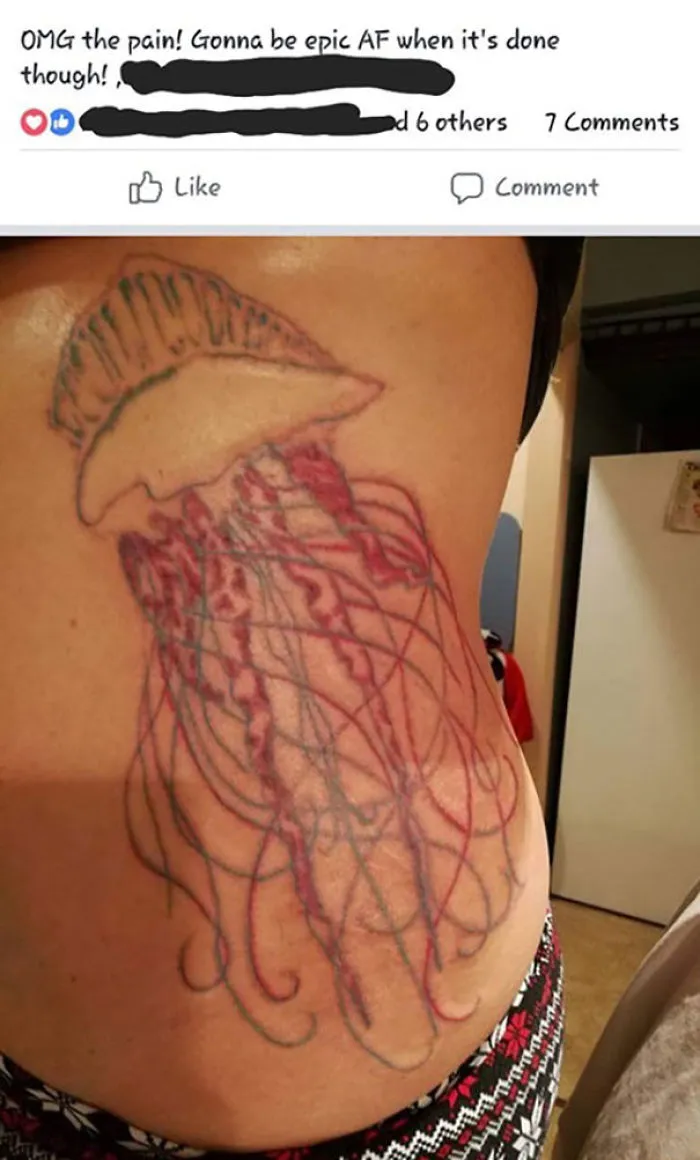 Bad tattoo fail showing an unfinished jellyfish design on the side of a person's torso.