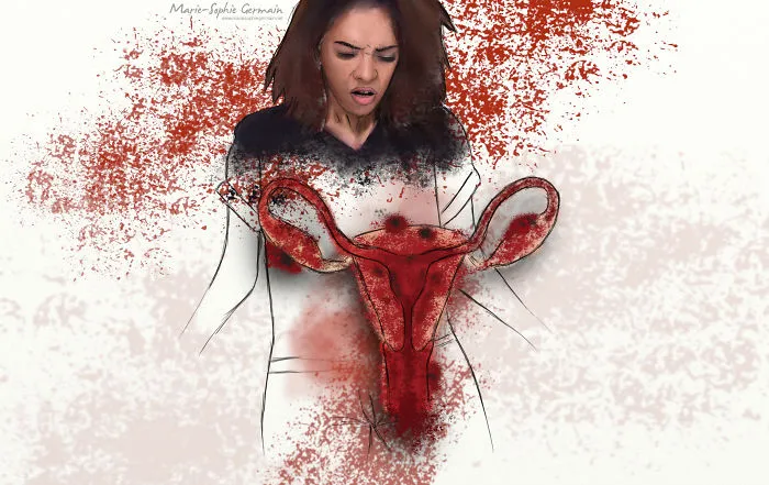 I Make Rough Drawings To Show The Reality Of Endometriosis