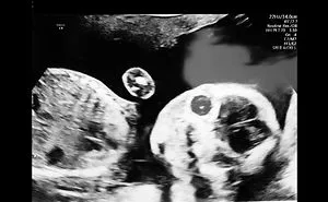 We Recorded Everyone's Reactions To Our Pregnancy