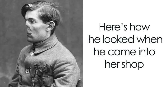 Fascinating Before & After Pics Show How This Woman Changed Lives Of WWI Veterans By 'Restoring' Their Faces