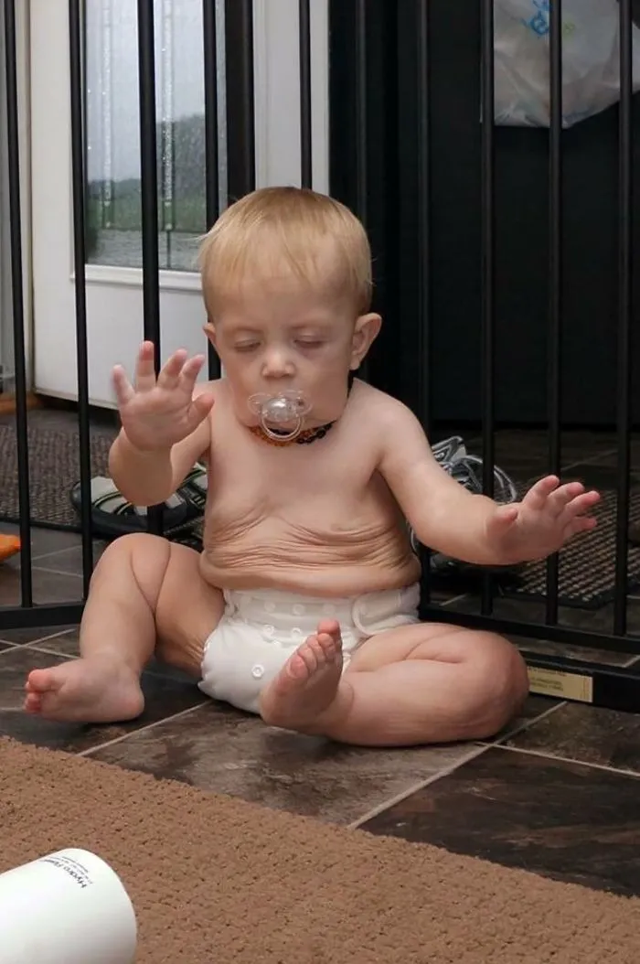 Old Baby. My Son Just As He Plopped Down From Standing