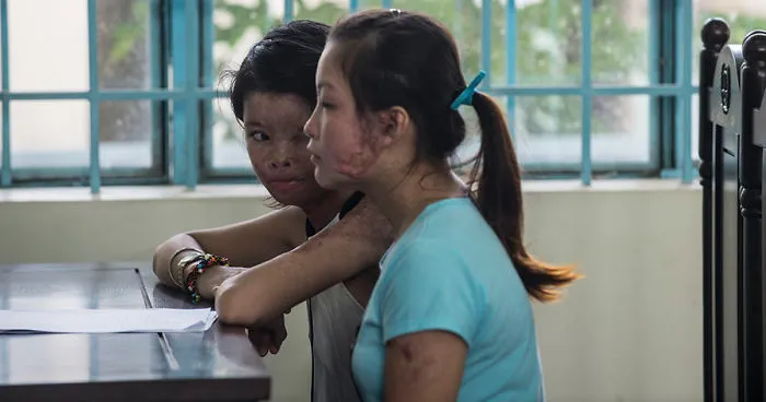 Can Tho City In Vietnam Opened The Trial Court Because Of The Intentionally Caused Injury With Acid
