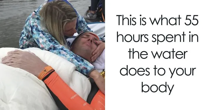 The Way This Man's Body Looks After Swimming 163 Km In 55 Hours Will Freak You Out