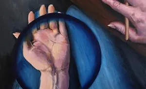 I Had A Detached Retina And Painted What I Saw