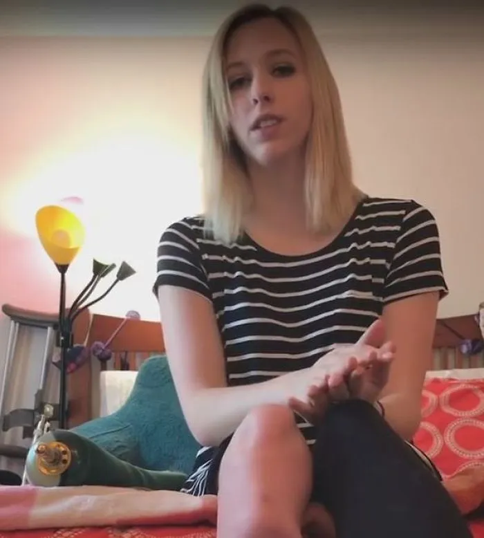 Amputee Gives Advice To Future Amputee