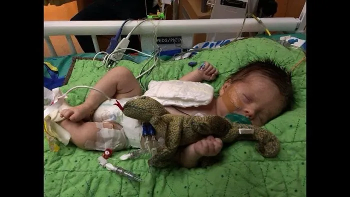 This Baby Was Diagnosed As Terminal In The Womb, But The Parents Decided To Leave His Fate To God
