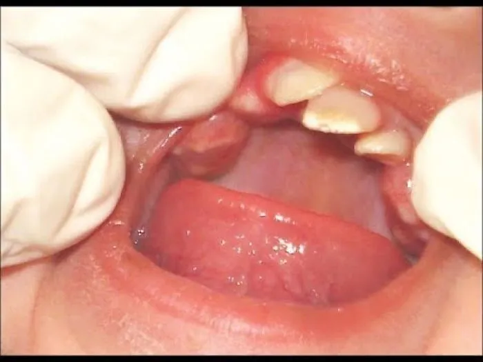 This Girl Was Born With A Very Rare Growth – And It Was Something The Dentist Had Never Seen Before