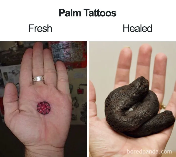 Comparison of palm tattoos: a fresh tattoo on one hand and a humorous healed result resembling a poop emoji on the other.