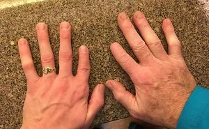 30 People Whose Genetics Made Them Unique