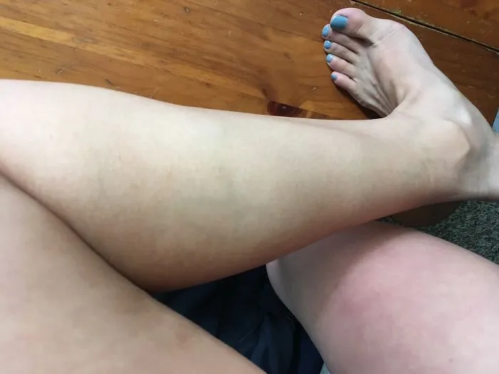 Does Anyone Have A Design Or Number In Their Veins?