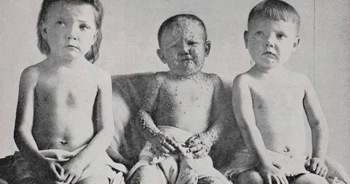 Ben Franklin Has The Best Comeback For Anti-Vaxxers And It Was Written 230 Years Ago