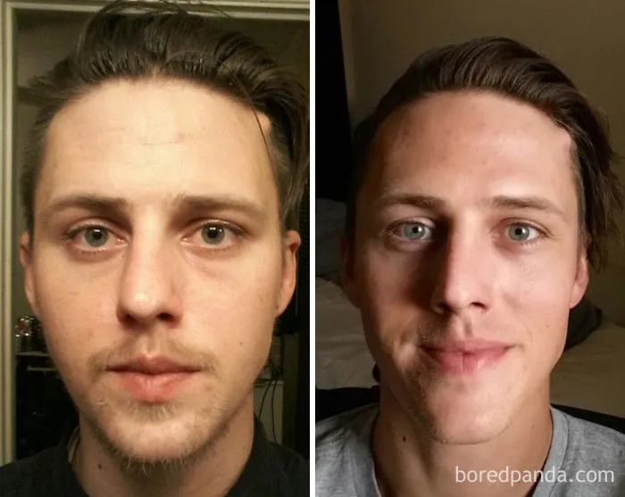 Before and after comparison of a man's face, highlighting changes after stopping drinking.
