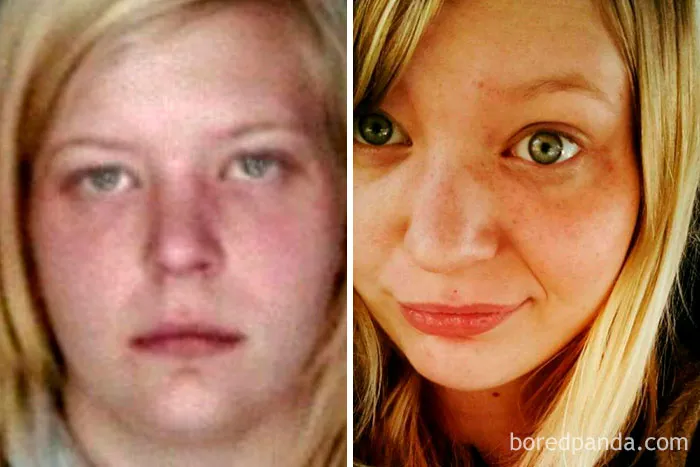 Before and after images showing the transformation when you stop drinking alcohol.