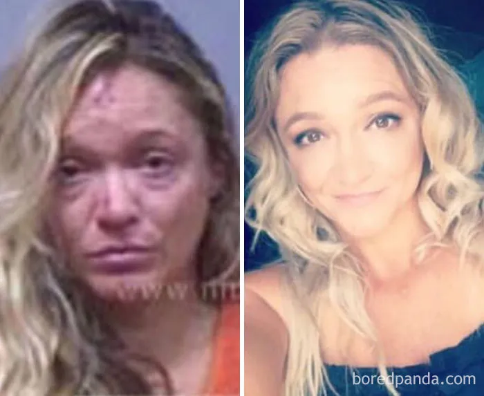 Before and after comparison showing changes when you stop drinking.