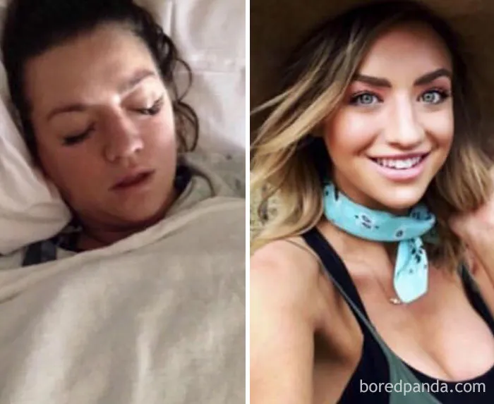 Before and after image showing changes when stopping drinking.