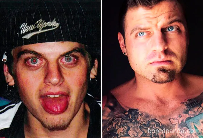 Before and after images showing transformation when stopping drinking, highlighting changes in face and expression.