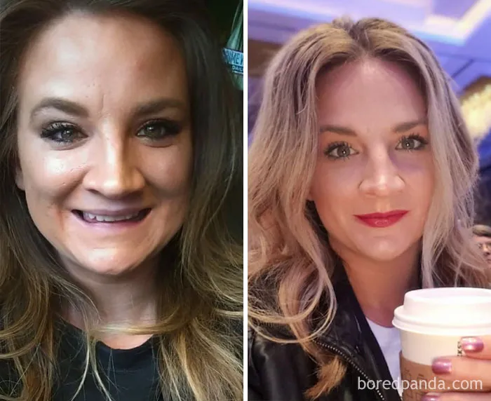 Before and after quitting drinking: woman's improved appearance.