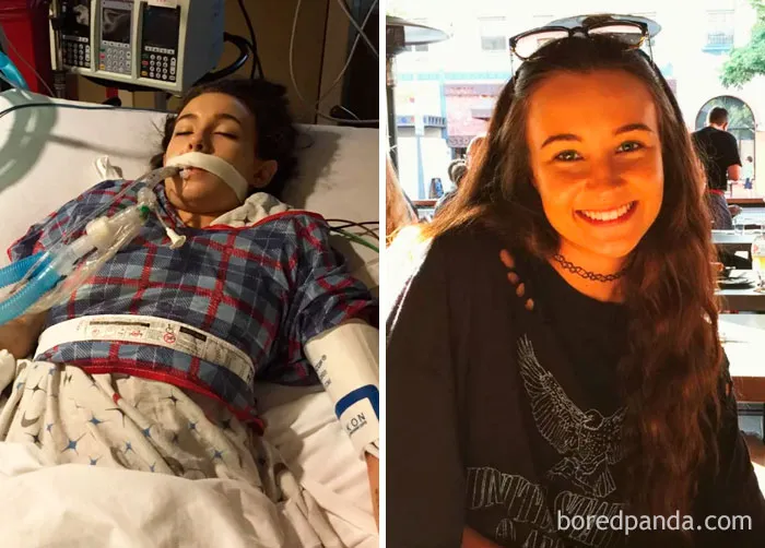 Left Is Me In The ICU From An Overdose. Decided I Was Sick And Tired Of Being Sick And Tired And Am 6 Months Clean And Sober Today
