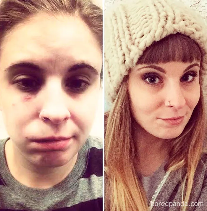 Before and after photos showing transformation after stopping drinking, with noticeable positive changes in appearance.
