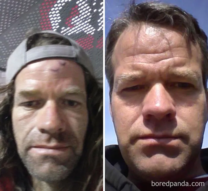 Before and after photos showing transformation when you stop drinking, highlighting improved appearance and health.