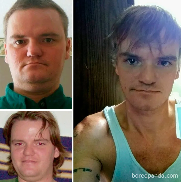 Before and after photos showing transformation after stopping drinking.