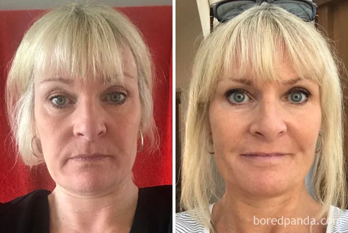 Before and after photo showing changes in a woman's appearance after quitting drinking.