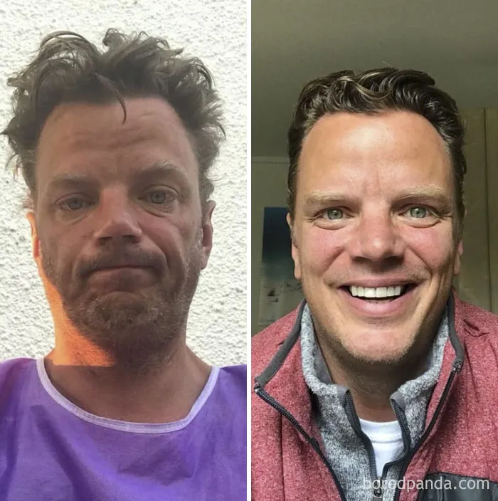 I Took The Picture On The Left Almost 17 Months Ago, Outside An Emergency Room, At Sunrise, Something Told Me I Didn’t Want To Forget That Moment. I Forget Easily.  I’m Going Public With This Now Simply Because I Need To Advocate For Recovery More