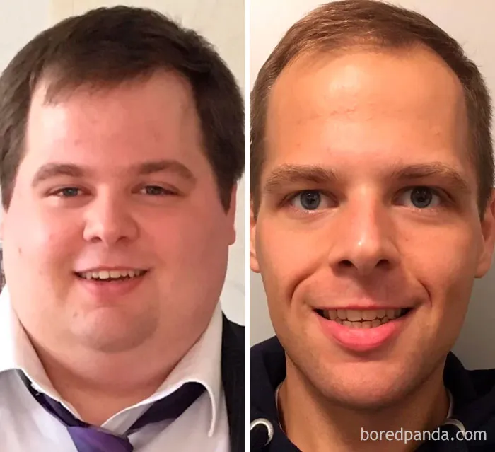 Lost 187 Lbs. Well, That's Both Me. 12 Months Of Dieting, Maintaining Since May. I'll Never Go Back To The Left