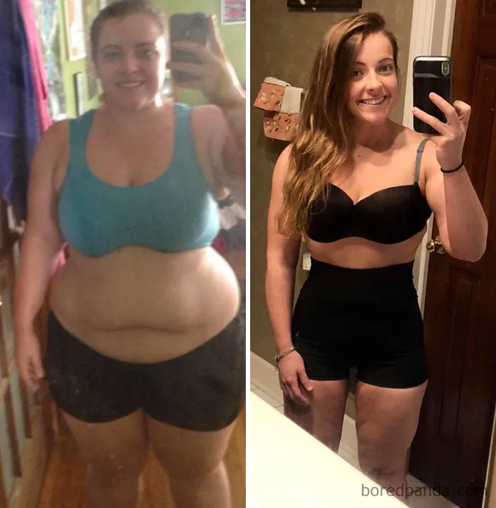140 Lbs Down. I Lost 1/2 Of Me, Time For Skin Removal Surgery!