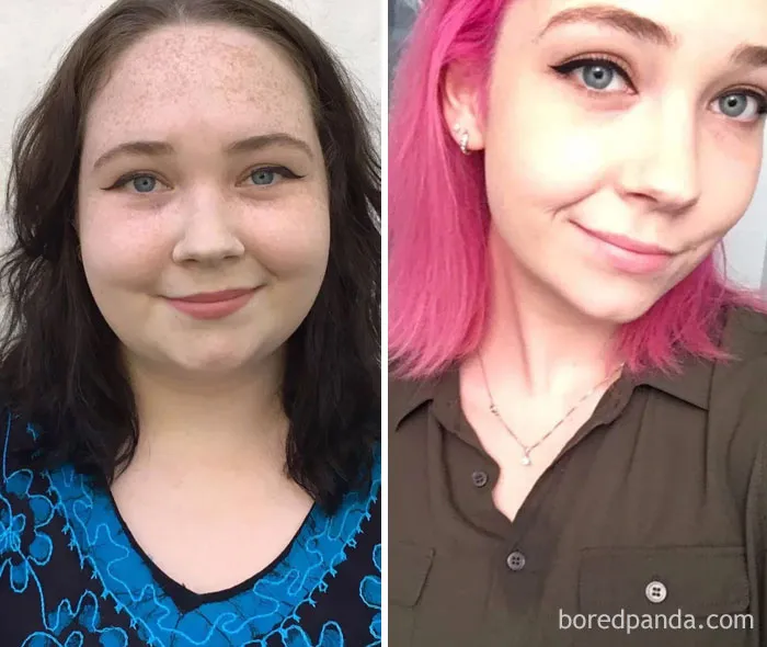 Lost 110 Lbs In 14 Months. Face Progress!