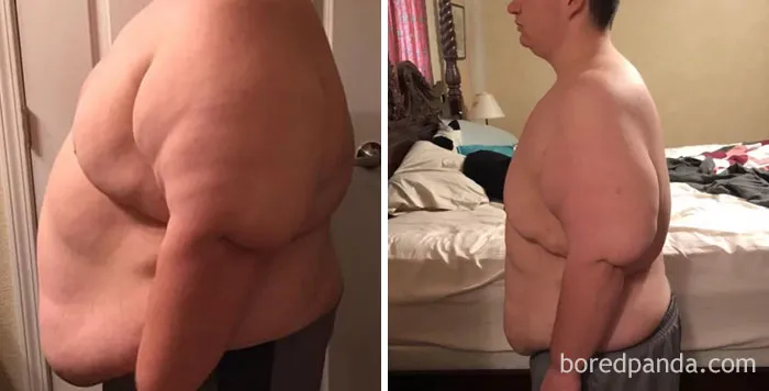 Lost 148 Lbs In 10 Months. Not Where I Want To Be Yet But I Am So Happy With My Progress